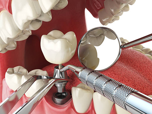 Best Emergency Treatment for Toothache in Ocean Acres, NJ